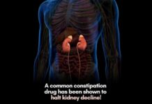 Constipation Drug Shows Promise in Slowing Kidney Disease in Early Clinical Trial